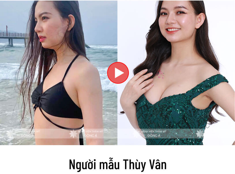 thumb-video