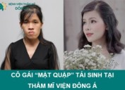 CÔ GÁI “MẶT QUẶP” TƯỜNG VY – HÀNH TRÌNH TÁI SINH NHAN SẮC TẠI THẨM MĨ VIỆN ĐÔNG Á