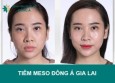 Tiêm meso Đông Á Gia Lai có tốt không?