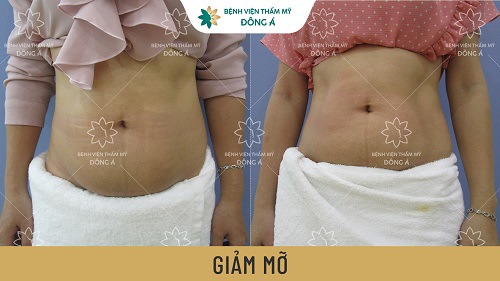  Hình ảnh khách hàng trước và sau khi thực hiện
