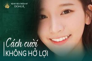 4 Cách cười không hở lợi – Áp dụng ngay – Hiệu quả tức thì