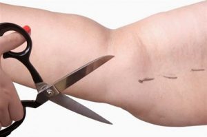 Cách giảm mỡ bắp tay nhanh nhất tại nhà cho bạn đôi tay thon gọn