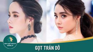 Gọt trán an toàn, giải pháp tạm biệt trán dô chỉ với 25 phút!