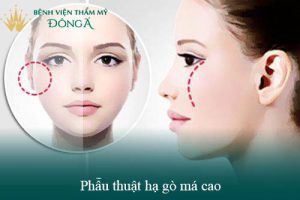Làm sao để khuôn mặt đầy đặn hơn? Gợi ý 10 cách làm đầy mặt tại nhà