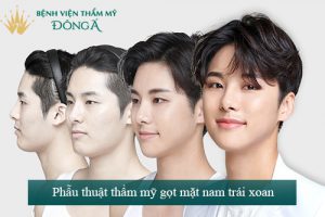 Mặt trái xoan nam là gì? Cách sở hữu mặt trái xoan nam Hoàn Hảo