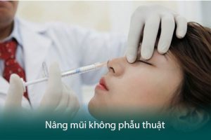 Sống mũi tẹt là như thế nào? Có mấy loại? Làm sao để hết mũi tẹt