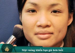 Phẫu thuật mặt vuông – Giúp gương mặt thon gọn hơn chuẩn V line