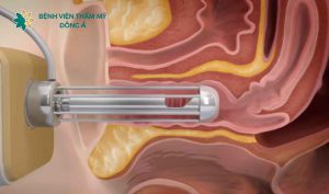 Update làm đẹp bảng giá vùng kín mới nhất