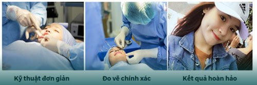 tao lúm đồng tiền