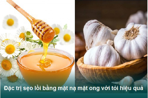 4 Cách trị sẹo lồi bằng tỏi đơn giản, hiệu quả ngay tại nhà 3