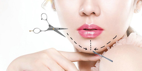 Độn cằm bằng mỡ tự thân - 30 phút có ngay khuôn mặt chuẩn VLine 5