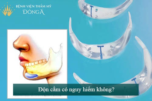 Độn cằm có nguy hiểm không & Lưu ý Quan Trọng cần biết 1