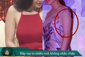 GIẢM MỠ BẮP TAY BẰNG MUỐI: 5 TUYỆT CHIÊU NÊN THỬ NGAY!