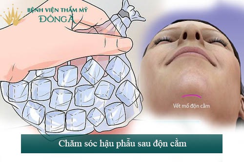 7 Lưu ý khi độn cằm để Cằm ĐẸP bền vững & An toàn tuyệt đối 3