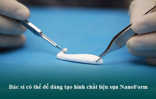 Nâng mũi sụn nhân tạo được bao lâu? Có được vĩnh viễn không? Hình 5