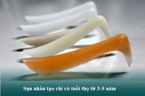 Nâng mũi sụn nhân tạo được bao lâu? Có được vĩnh viễn không? Hình 2