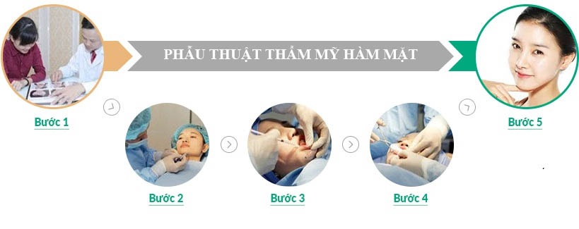 Thẩm mỹ làm đầy khuôn mặt là gì? Giá bao nhiêu tiền? 4