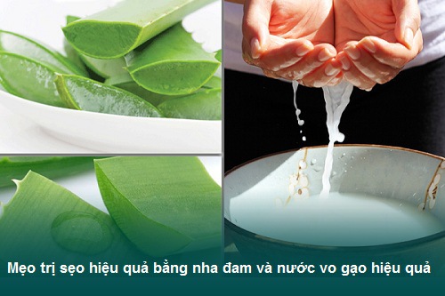 Mẹo trị sẹo rỗ bằng nha đam hiệu quả siêu bất ngờ 2