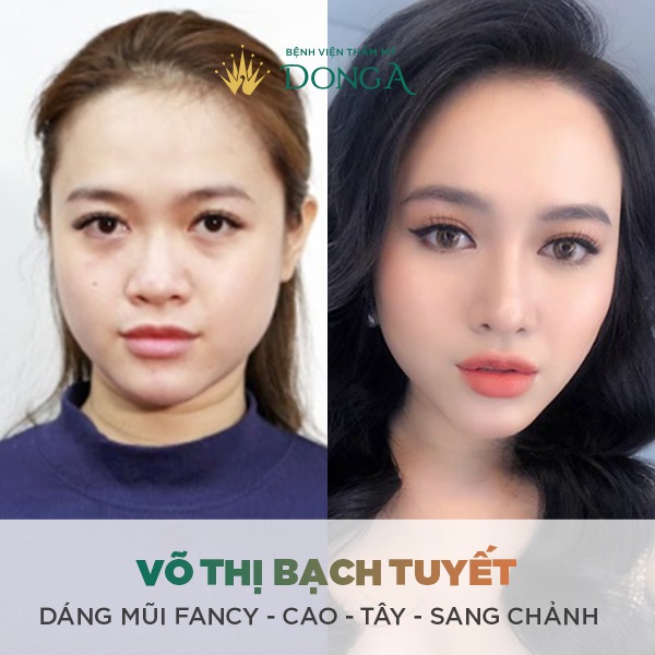 Lộ diện Top 4 DÁNG MŨI ĐẸP xuất sắc nhất năm 2019 3