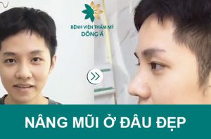 Nâng mũi ở đâu đẹp? Review địa chỉ thẩm mỹ uy tín, an toàn #1