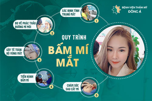 quy trình bấm mí mắt