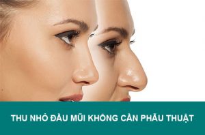 Cảnh báo: Thu nhỏ đầu mũi không cần phẫu thuật lợi bất cập hại!