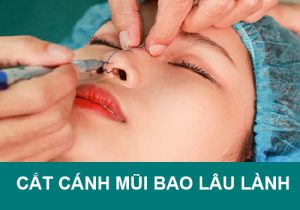 Cắt cánh mũi bao lâu thì Lành & Không để lại seo, Đẹp rạng ngời