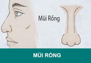 Mũi Rồng là gì: Xem dáng mũi, Dự đoán vận số “Sang Hèn”