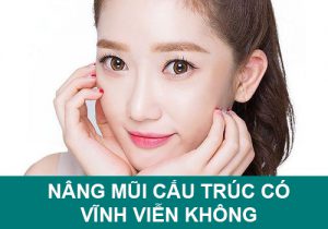 Nâng mũi cấu trúc có vĩnh viễn không? Tuổi thọ được bao lâu?