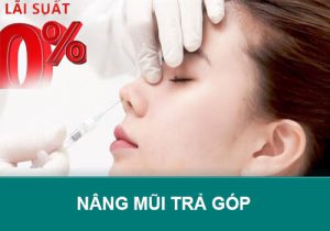 Nâng Mũi Trả Góp: Cảnh giác với “Bẫy” sữa mũi 0% Lãi Suất