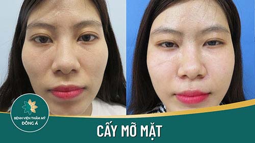 Gương mặt bầu bĩnh xinh đẹp của chị khách nhà Đông Á