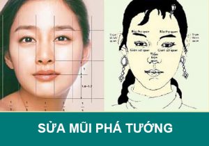 Sửa mũi Phá Tướng: Đông Á giải đáp ảnh hưởng đến Tướng Số