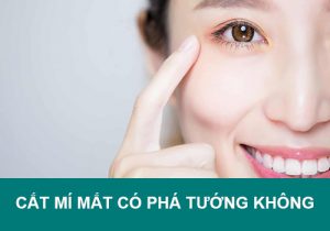Cắt mí mắt có phá tướng không? Nên hay không nên thực hiện?