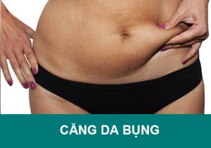 Căng da bụng giá bao nhiêu? Bao lâu hồi phục? Làm ở đâu đẹp?