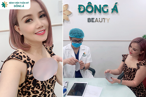 Tư vấn Nâng ngực cùng bác sĩ
