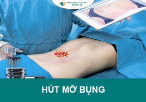 Hút mỡ bụng AN TOÀN, HIỆU QUẢ với SlimLipo Vaser – Đến NGAY ĐÔNG Á!