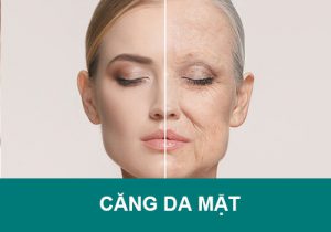 Căng da mặt giá bao nhiêu tiền? Được bao lâu? Quy trình thực hiện