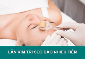 Lăn kim trị sẹo giá bao nhiêu tiền? Bảng chi phí RẺ nhất