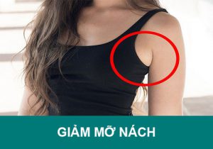 9 Cách Giảm Mỡ Nách đơn giản tại nhà cho hiệu quả nhanh