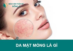 Da mặt mỏng, đỏ, nổi gân máu: 3 Cách chăm sóc để phục hồi dày lại