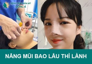 Nâng mũi bao lâu thì lành hẳn? Tips để mũi sớm đẹp, hết sưng đau