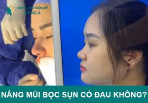 Nâng mũi bọc sụn có đau không? Bao lâu hết? 4 Mẹo để giảm nhức hiệu quả