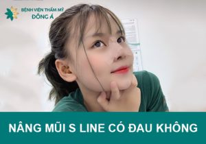 Nâng mũi S Line có an toàn không? Có đau không? Địa chỉ phẫu thuật uy tín