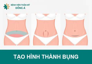 Phẫu thuật tạo hình thành bụng: Eo săn chắc, quyến rũ sau 90′