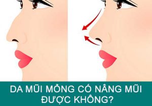 Da mũi mỏng có nâng mũi được không? 3 Lưu ý cần Nắm Bắt rõ