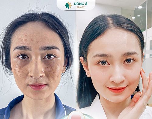 điện di viramin c ở đâu