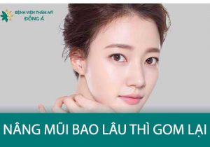 Nâng mũi bao lâu thì Gom, Gộp lại, mũi vào Phom chuẩn dáng?