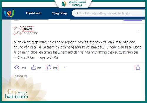 cảm nhận khách hàng trị nám tàn nhang kiên giang