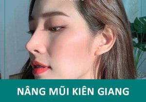 Nâng mũi Kiên Giang – Dịch vụ làm đẹp hot nhất hiện nay