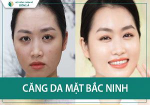 Giải đáp căng da mặt ở Bắc Ninh tại địa chỉ nào tốt nhất?